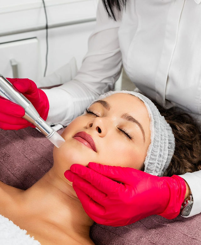 Le stylo de microneedling passé sur le visage